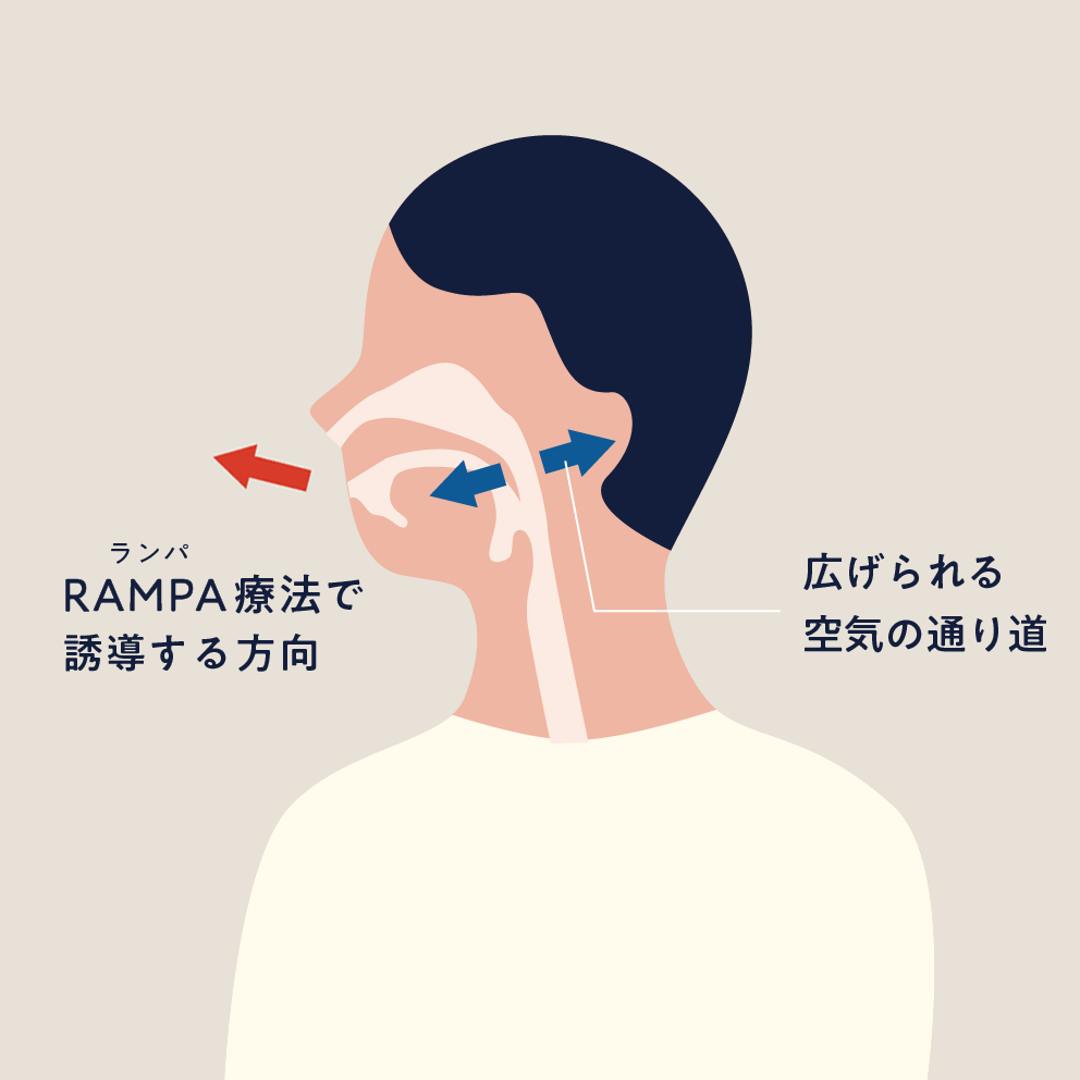 おかむら小児歯科クリニック RAMPA療法 画像